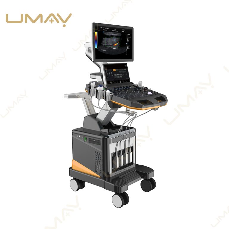 Mobile Trolley Ultrasound Machine Left View