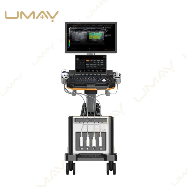 Front view of a dual-screen trolley ultrasound machine with a widescreen monitor displaying a side-by-side ultrasound elastography scan.