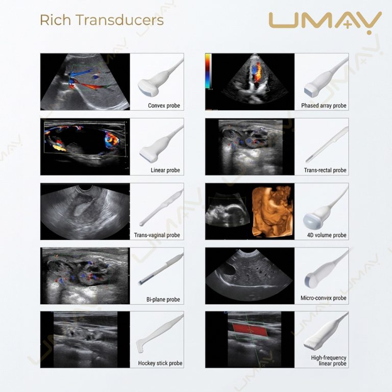 Ultrasound Transducer Probe Application Chart