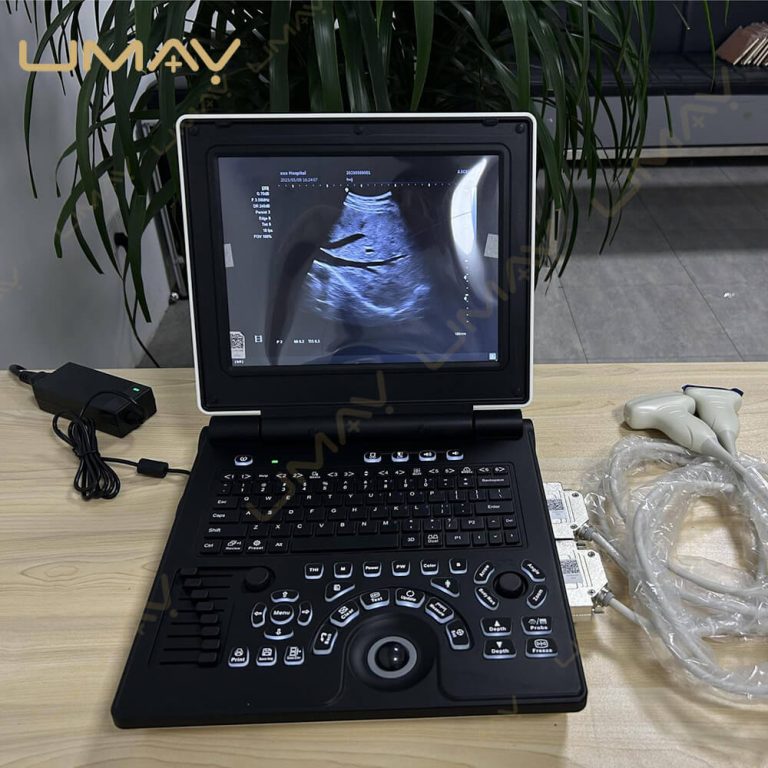 Ultrasound Machine