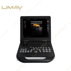 Portable Laptop Ultrasound Machine Active Screen