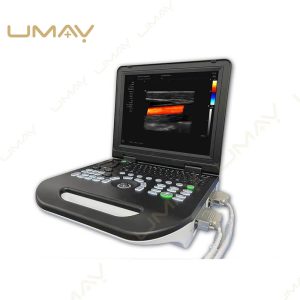 Laptop Ultrasound Machine with Connected Probes