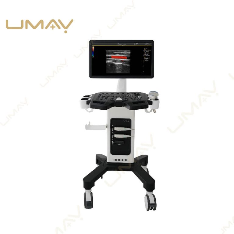 Front view of a mobile trolley ultrasound machine with a widescreen monitor displaying a red vascular color Doppler scan.