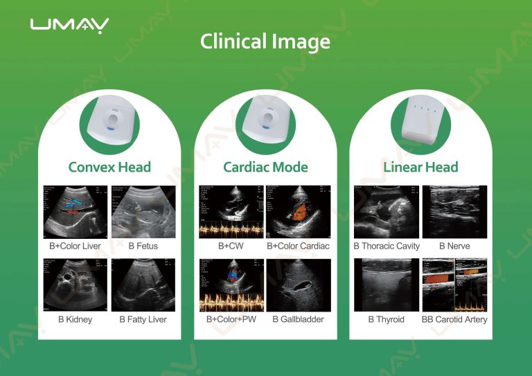 3-in-1 Handheld Ultrasound Clinical Scan Examples
