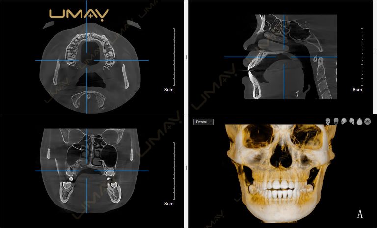 Dental CBCT 3D Reconstruction Software View
