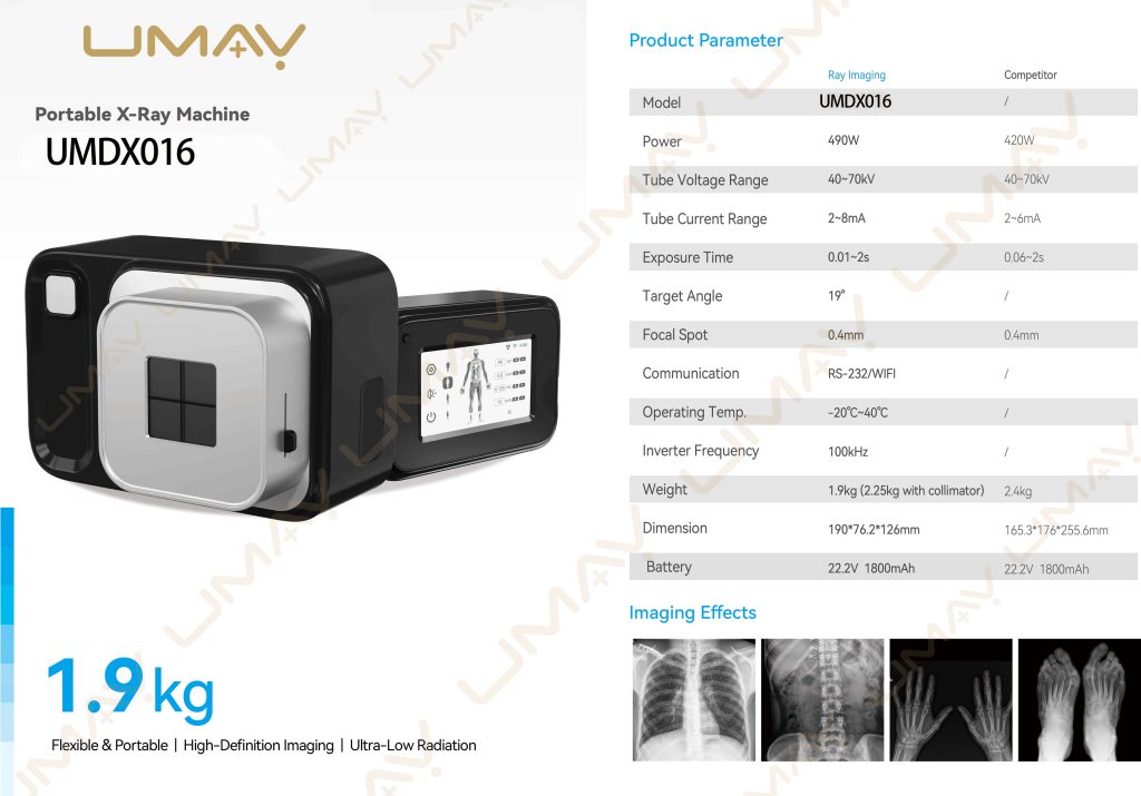 Technical specification datasheet for UMDX016 1.9kg lightweight portable X-ray machine with sample radiographs.