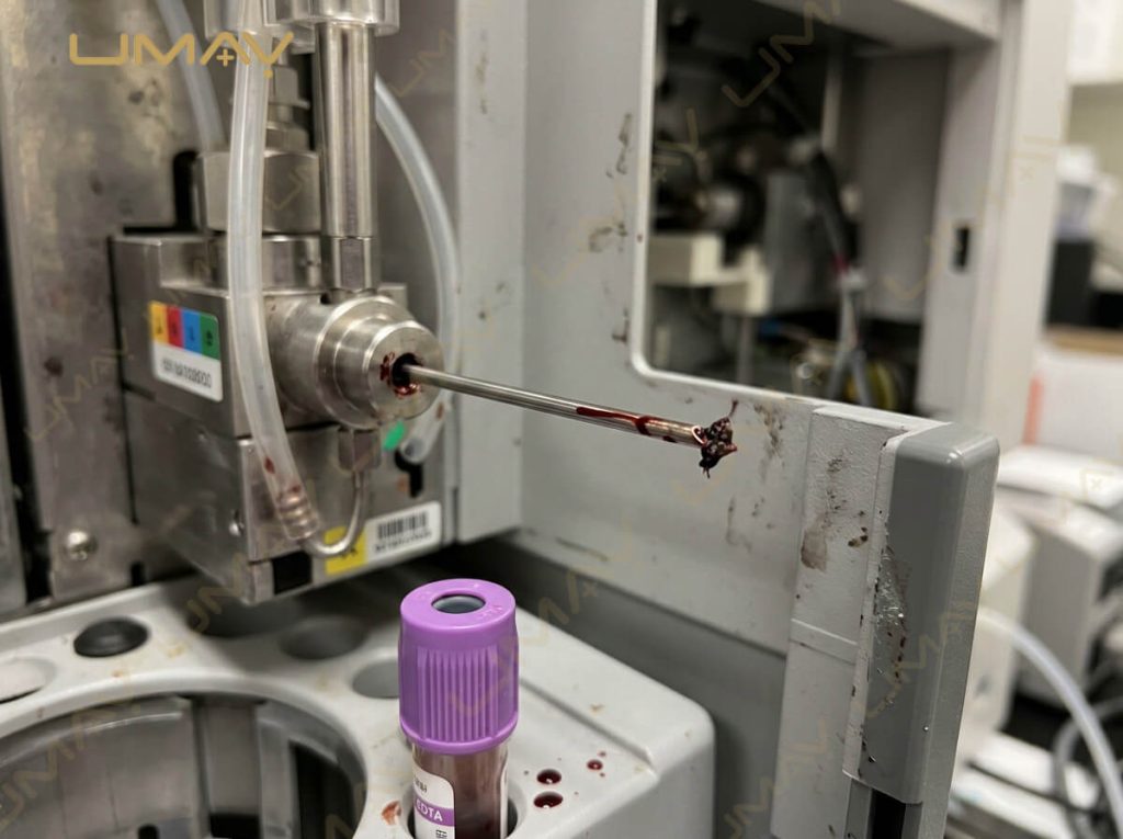 Close-up of a clogged sample aspiration needle on a hematology analyzer requiring maintenance.