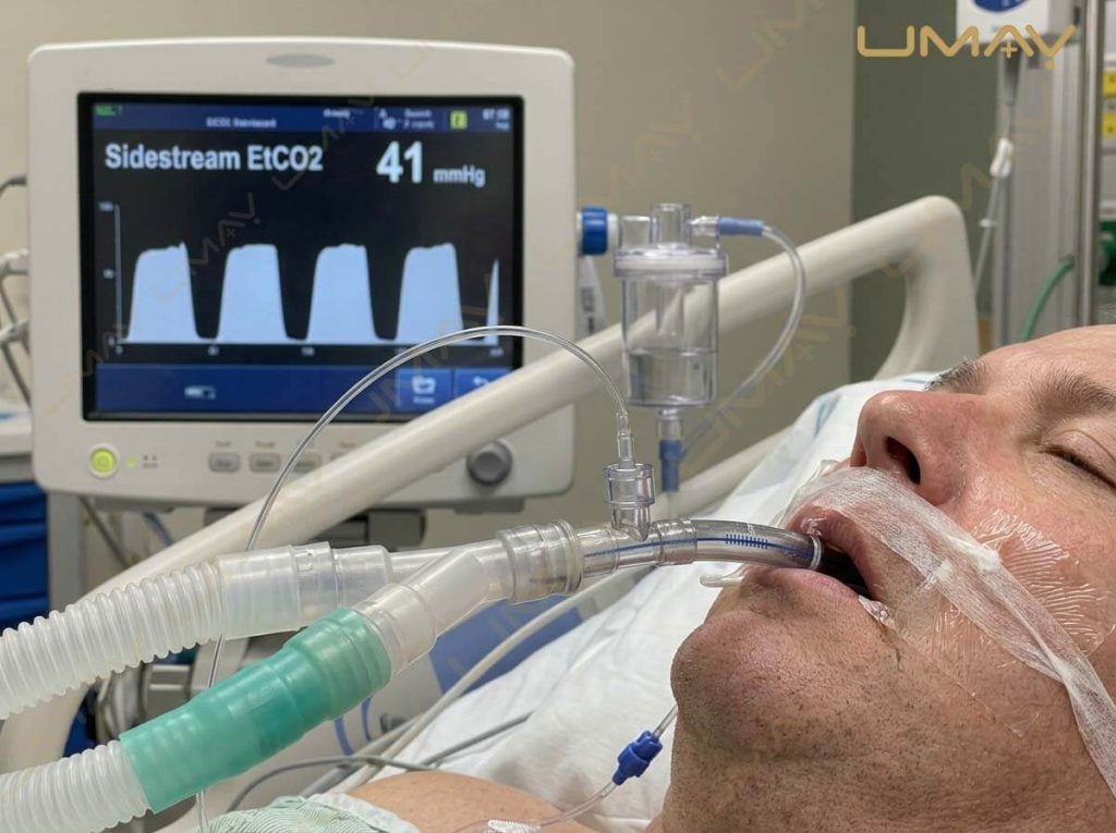 Intubated ICU patient with sidestream EtCO2 capnography sampling tube connected to a bedside monitor.