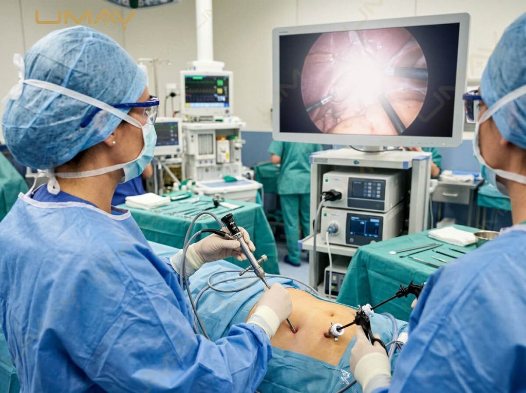 Surgeons using laparoscopic rigid endoscope and surgical trocars during minimally invasive procedure with HD monitor display.