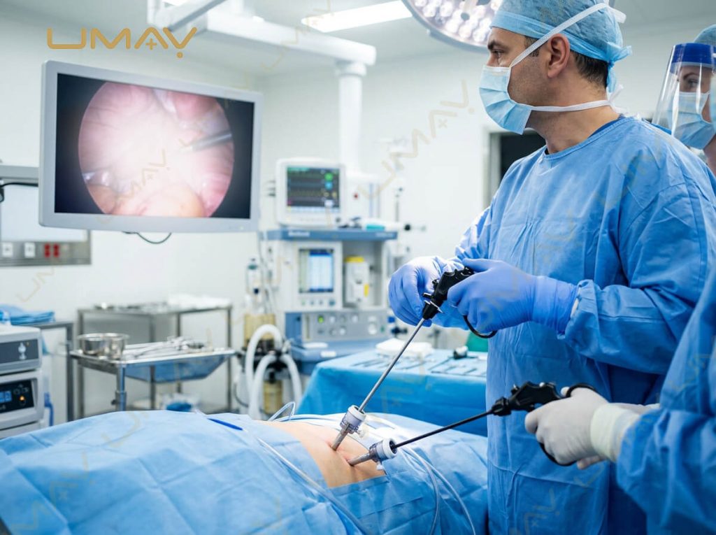Surgical team performing laparoscopic surgery with rigid endoscopic camera tower and HD monitor.