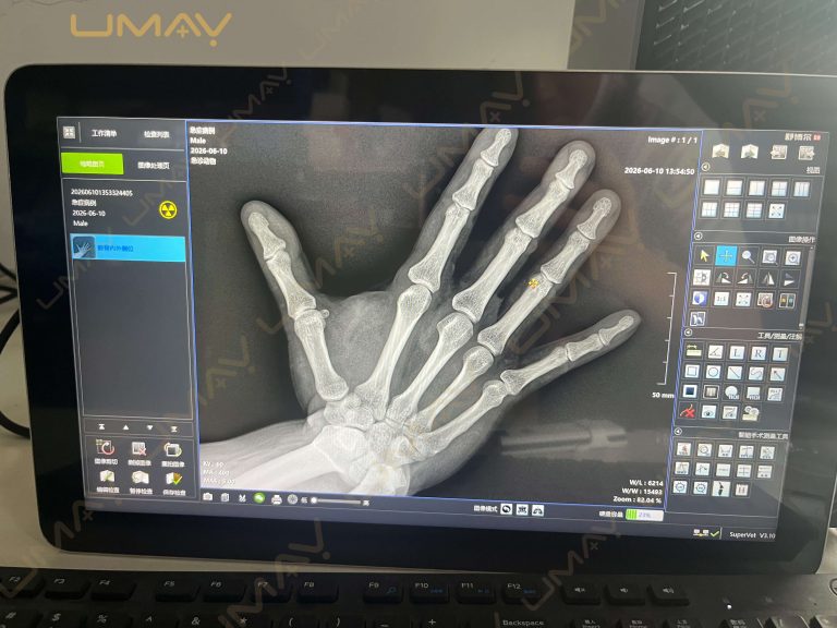 Veterinary Digital Radiography Imaging Software
