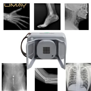 Complete Portable Digital Radiography Kit