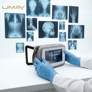 Professional Operating Touch Screen Portable X-Ray
