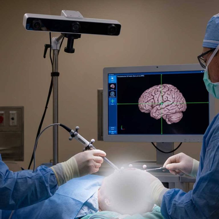 Neurosurgeon using optical tracking pointer and 3D brain model on surgical navigation display.