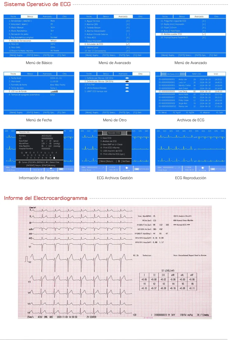ECG Operating System Interface and Thermal Printout Report