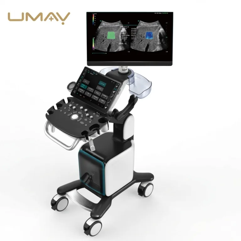 Mobile cart-based diagnostic ultrasound machine displaying dual abdominal imaging scans.